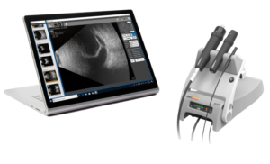 AB-Scan